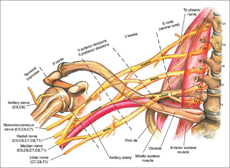 Patterns Of Injury To The Infraclavicular Brachial Plexus Following Dislocation Of The