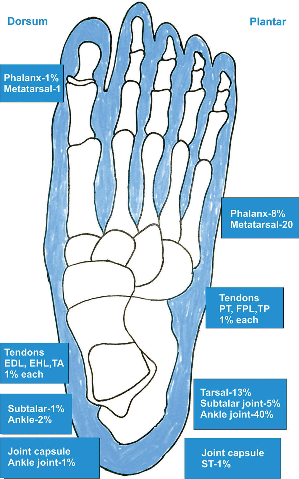 Illustrative image showing the common locations of the tumors in the foot and ankle. EDL: Extensor digitorum longus, EHL: Extensor hallucis longus, TA: Tibialis anterior, TP: Tibialis posterior, FPL: Flexor pollicis longus, ST: Semitendinosus tendon, PT: Pronator teres.