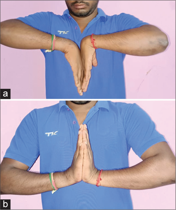 (a and b) This clinical image demonstrates the wrist movements of the same patient, showcasing a normal range of motion with painless movement.