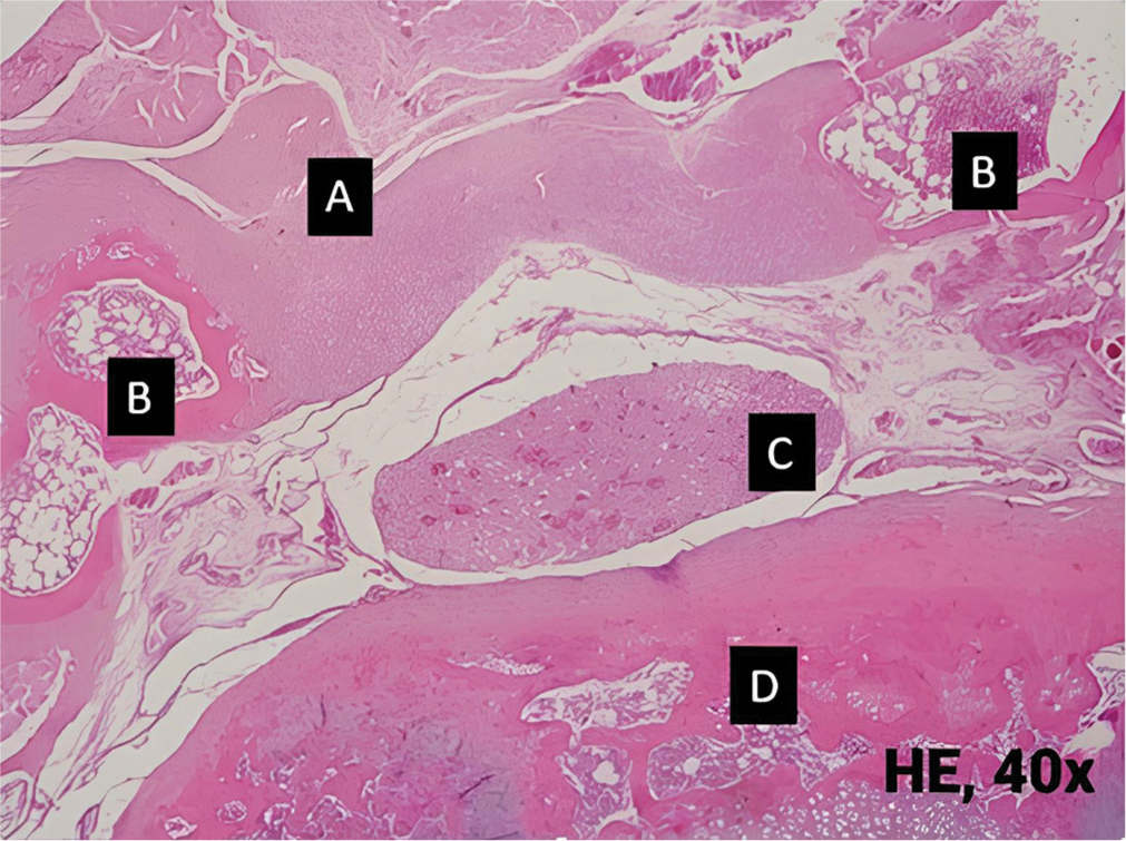 Histopathological view of grade I epidural fibrosis on Autologous fat group. Only slight fibrous tissue is observed. (A): Epidural fibrosis, (B): Bone, (C): Cauda equina, (D): Vertebral body. HE: Hematoxylin and eosin.