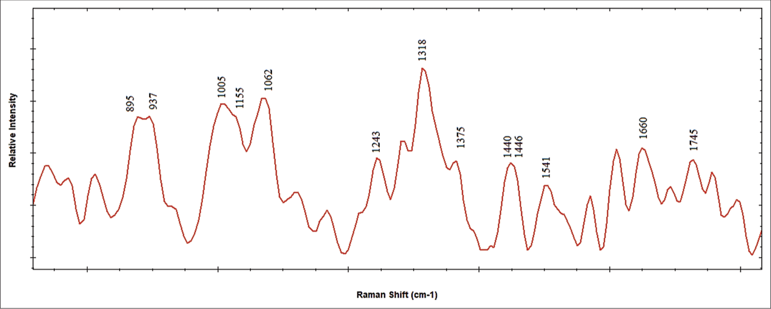 Displays Raman spectra of synovial fluid with labeled molecular profiling for biomarker identification.