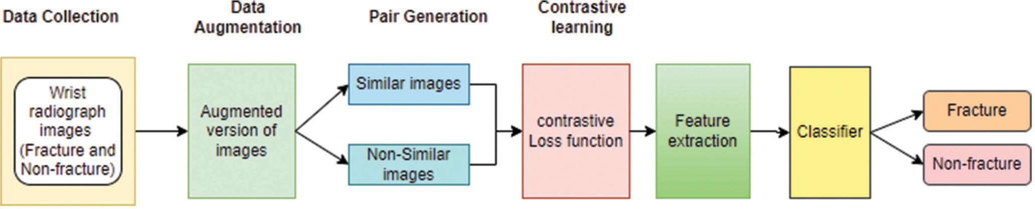 Architecture of self-supervised learning – Data collection, data augmentation, and pair generation followed by contrastive learning for feature extraction to classify fracture and not-fracture images.