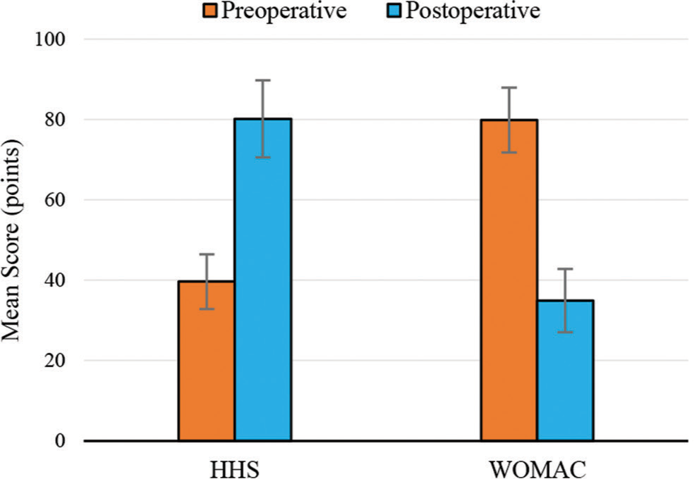 Pre-operative and post-operative HHS and WOMAC. HHS: Harris Hip Score, WOMAC: Western Ontario McMaster Osteoarthritis Index.