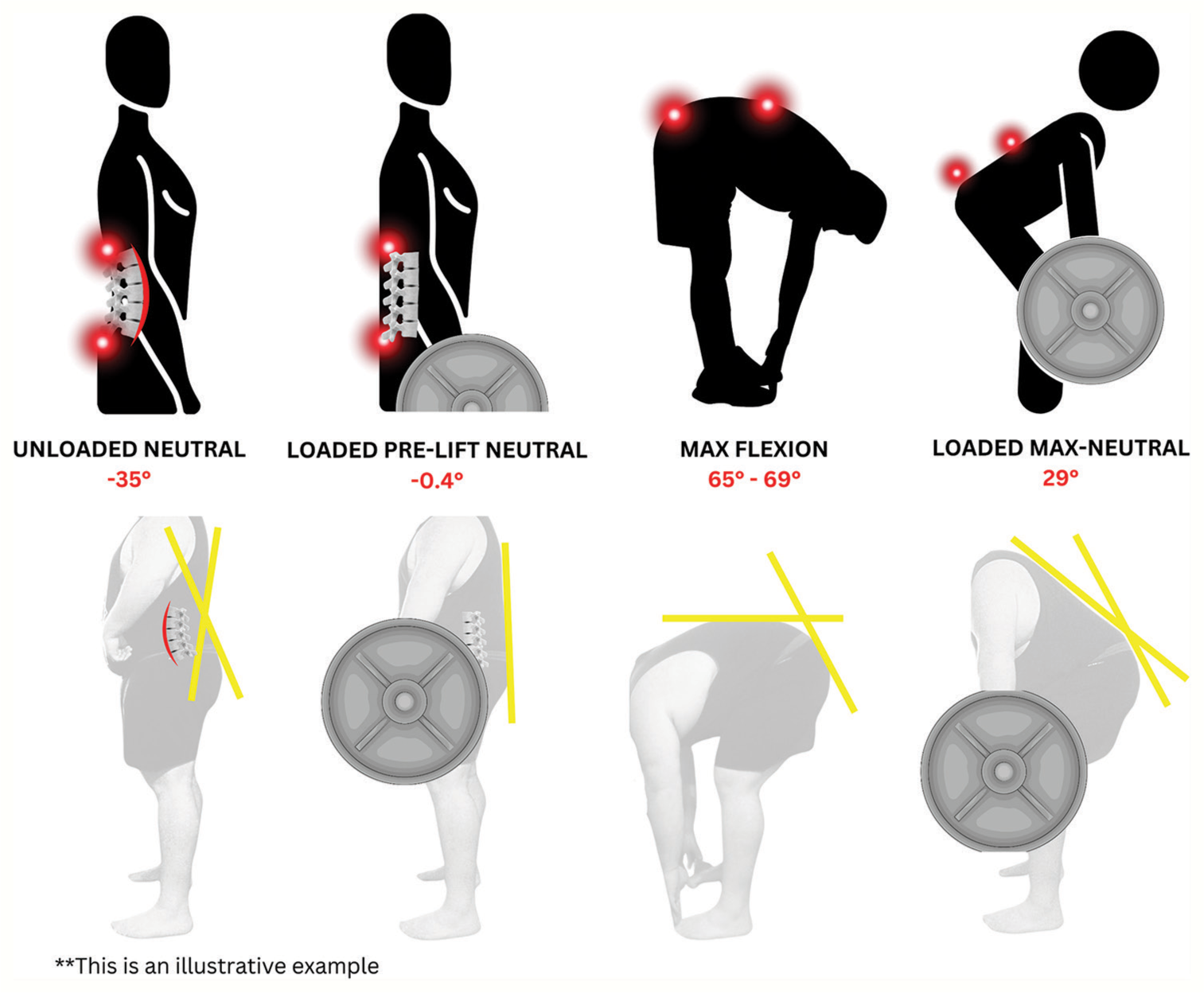 Spinal measurements.