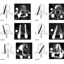 Article figure