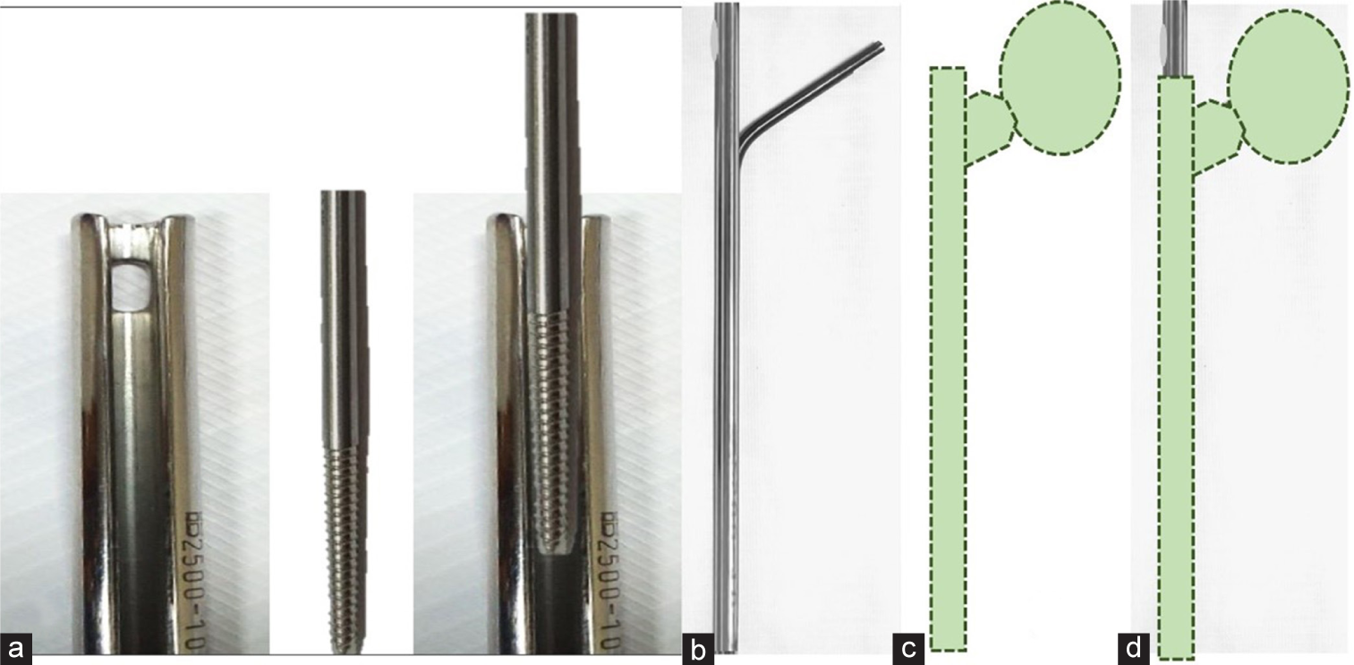 (a) Threaded 5 mm Schanz screw was tightened through the Kuntscher nail groove, (b) the proximal smooth Schanz end was bent 130° to mimic the neck-shaft angle, (c and d) the diagram shows a handmade spacer, Kuntscher nail coated with cement.